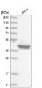 CAMP Responsive Element Binding Protein 3 antibody, NBP2-58307, Novus Biologicals, Western Blot image 