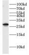 GTPase, IMAP Family Member 2 antibody, FNab03456, FineTest, Western Blot image 