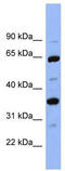 Serpin Family C Member 1 antibody, TA346038, Origene, Western Blot image 