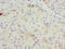BGP antibody, LS-C211390, Lifespan Biosciences, Immunohistochemistry paraffin image 