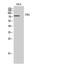 Connector enhancer of kinase suppressor of ras 1 antibody, A08845-1, Boster Biological Technology, Western Blot image 