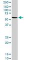 Glucose-6-Phosphate Isomerase antibody, H00002821-D01P, Novus Biologicals, Western Blot image 