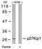 Cyclin Dependent Kinase Inhibitor 1B antibody, orb14737, Biorbyt, Western Blot image 