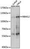 RNA Binding Motif Protein 12 antibody, LS-C749669, Lifespan Biosciences, Western Blot image 