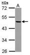 Transcription Factor AP-2 Beta antibody, GTX114832, GeneTex, Western Blot image 