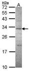 CD298 antibody, TA308247, Origene, Western Blot image 