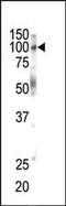 EPH Receptor B1 antibody, PA5-14604, Invitrogen Antibodies, Western Blot image 