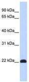 Kruppel Like Factor 16 antibody, TA345430, Origene, Western Blot image 