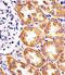 TST antibody, M00965, Boster Biological Technology, Immunohistochemistry paraffin image 