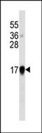 Interferon alpha-1 antibody, LS-C165256, Lifespan Biosciences, Western Blot image 