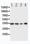 MYD88 Innate Immune Signal Transduction Adaptor antibody, LS-C312819, Lifespan Biosciences, Western Blot image 
