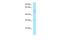 Chromosome 11 Open Reading Frame 42 antibody, A19560, Boster Biological Technology, Western Blot image 