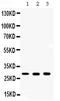Carbonic Anhydrase 2 antibody, PB9989, Boster Biological Technology, Western Blot image 