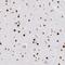 DExH-Box Helicase 9 antibody, NBP1-85266, Novus Biologicals, Immunohistochemistry frozen image 