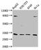 Dual Specificity Phosphatase 4 antibody, CSB-PA619752LA01HU, Cusabio, Western Blot image 