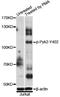 Protein Tyrosine Kinase 2 Beta antibody, STJ29378, St John