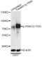 Protein Kinase C Delta antibody, LS-C750583, Lifespan Biosciences, Western Blot image 