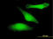 Glycogen Synthase Kinase 3 Beta antibody, LS-C133221, Lifespan Biosciences, Immunofluorescence image 