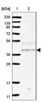 NSE4 Homolog A, SMC5-SMC6 Complex Component antibody, NBP1-90789, Novus Biologicals, Western Blot image 