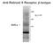 Retinoid X Receptor Beta antibody, GTX82600, GeneTex, Western Blot image 