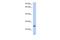 Tetratricopeptide Repeat Domain 9C antibody, A16938, Boster Biological Technology, Western Blot image 