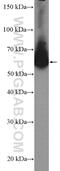 ADP Ribosylation Factor GTPase Activating Protein 2 antibody, 16519-1-AP, Proteintech Group, Western Blot image 