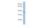EMI Domain Containing 1 antibody, GTX45874, GeneTex, Western Blot image 