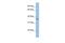 EMI Domain Containing 1 antibody, GTX45874, GeneTex, Western Blot image 