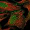 Kinesin Family Member 22 antibody, NBP1-82876, Novus Biologicals, Immunofluorescence image 