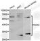 NADPH Oxidase 4 antibody, A2201, ABclonal Technology, Western Blot image 