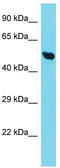 Translocase Of Inner Mitochondrial Membrane 50 antibody, TA334156, Origene, Western Blot image 