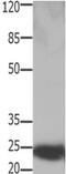 High Mobility Group Box 2 antibody, PA5-49720, Invitrogen Antibodies, Western Blot image 