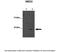 Methyl-CpG Binding Domain Protein 2 antibody, 29-201, ProSci, Enzyme Linked Immunosorbent Assay image 