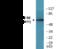 Ribosomal Protein S6 Kinase B1 antibody, EKC2488, Boster Biological Technology, Western Blot image 