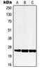 Lecithin Retinol Acyltransferase antibody, orb214879, Biorbyt, Western Blot image 