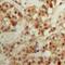 Core-Binding Factor Subunit Beta antibody, LS-C368668, Lifespan Biosciences, Immunohistochemistry frozen image 