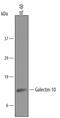 Charcot-Leyden Crystal Galectin antibody, PA5-47741, Invitrogen Antibodies, Western Blot image 
