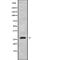 OTU Deubiquitinase, Ubiquitin Aldehyde Binding 2 antibody, abx217567, Abbexa, Western Blot image 