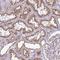 CLC antibody, NBP2-38638, Novus Biologicals, Immunohistochemistry frozen image 