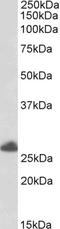 Tripartite Motif Containing 40 antibody, EB05890, Everest Biotech, Western Blot image 