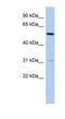 Transmembrane Protein 161B antibody, NBP1-91442, Novus Biologicals, Western Blot image 