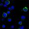 Receptor Tyrosine Kinase Like Orphan Receptor 1 antibody, MA5-15539, Invitrogen Antibodies, Immunofluorescence image 
