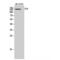 Patatin Like Phospholipase Domain Containing 6 antibody, LS-C384978, Lifespan Biosciences, Western Blot image 