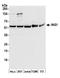 Inhibitor Of Growth Family Member 1 antibody, A304-997A, Bethyl Labs, Western Blot image 