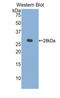 Kallikrein 1 antibody, LS-C298268, Lifespan Biosciences, Western Blot image 