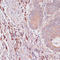 Interferon Alpha And Beta Receptor Subunit 2 antibody, A02056, Boster Biological Technology, Immunohistochemistry paraffin image 
