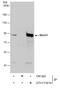 MRE11A antibody, GTX111814, GeneTex, Immunoprecipitation image 