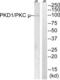 Serine/threonine-protein kinase D1 antibody, LS-C117775, Lifespan Biosciences, Western Blot image 