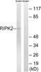 Receptor Interacting Serine/Threonine Kinase 2 antibody, LS-C199543, Lifespan Biosciences, Western Blot image 