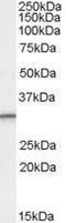 Proteasome Activator Subunit 1 antibody, GTX89093, GeneTex, Western Blot image 